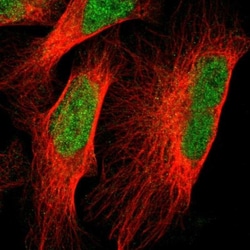 VEZT Antibody, Novus Biologicals 0.1mL; Unlabeled:Antibodies, Polyclonal
